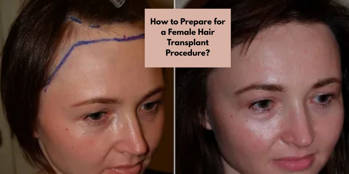 How to Prepare for a Female Hair Transplant Procedure?