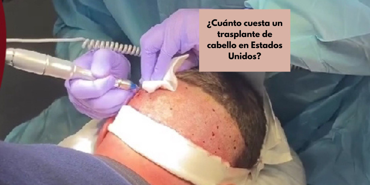 ¿Cuánto cuesta un trasplante de cabello en Estados Unidos?