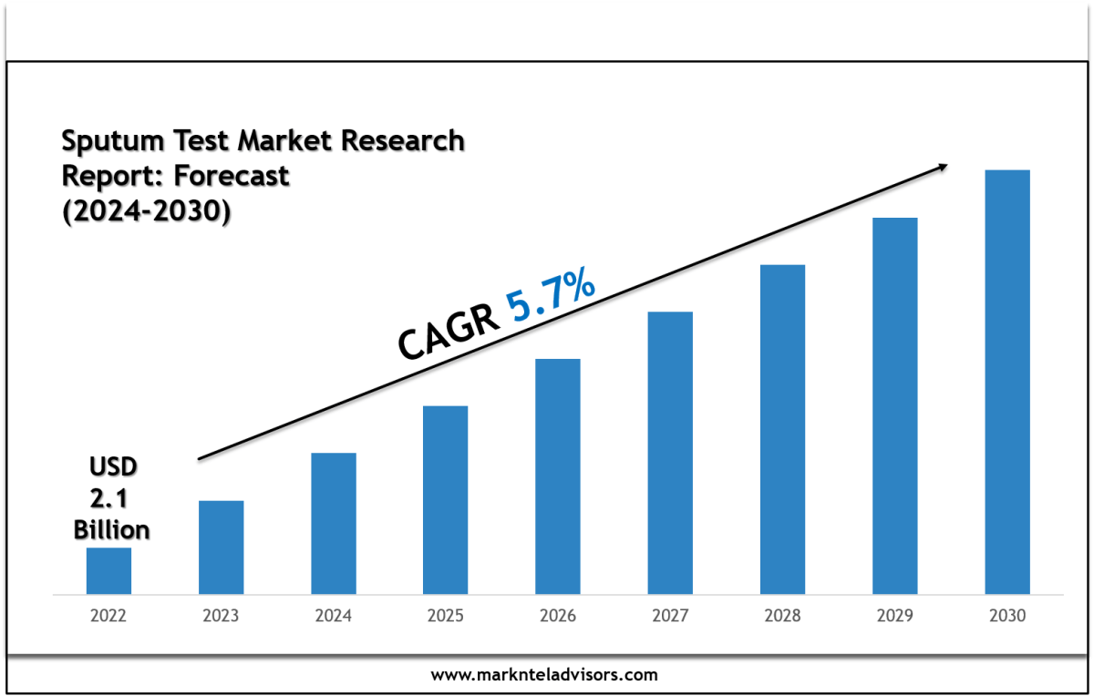 Leading Players & Segments in the Sputum Test Market 2030 – Site Title